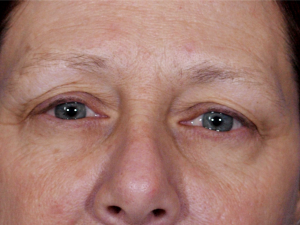 muede rote Augen